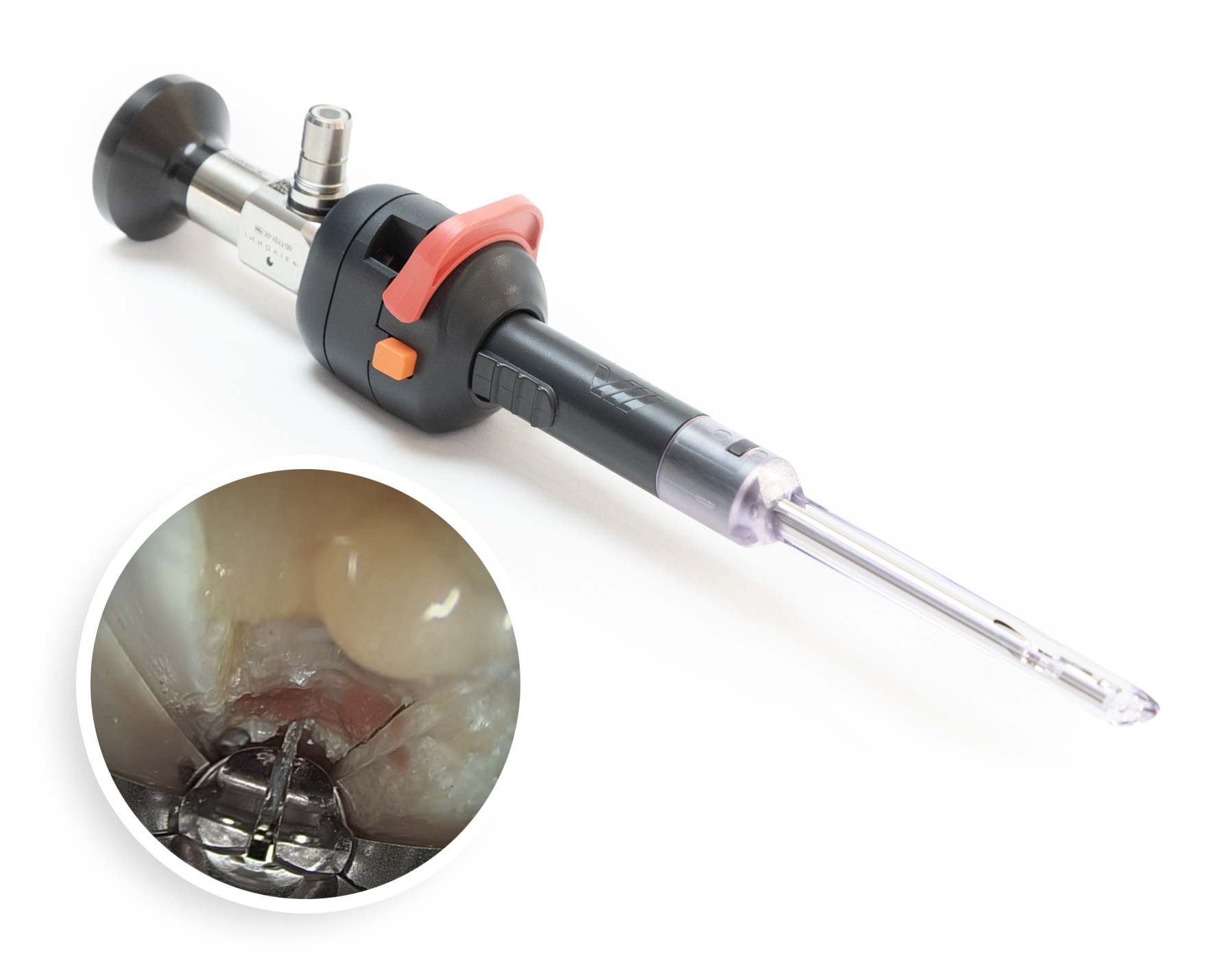 RETRA device with endoscopic view