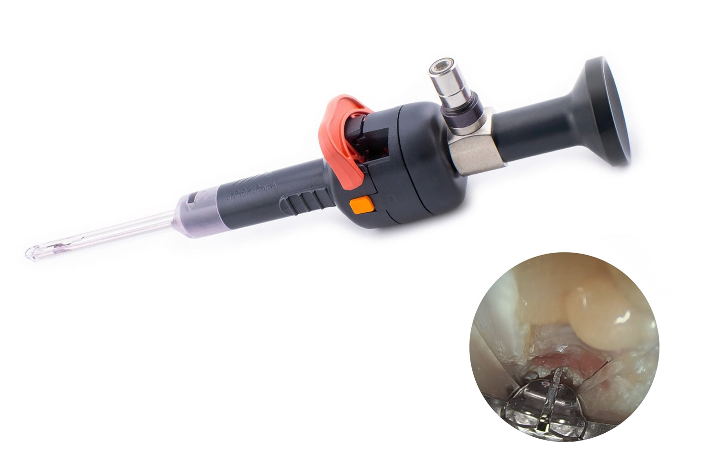 RETRA endoscopic release system